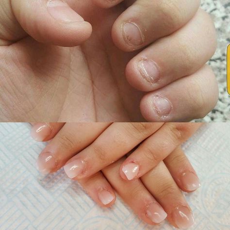 Wide Nail Bed, Short Bitten Nails, Bitten Nails, Really Short Nails, Acrylic Ombre, Wedding Nail Polish, Natural Acrylic, Sculptured Nails, Spring Acrylic Nails