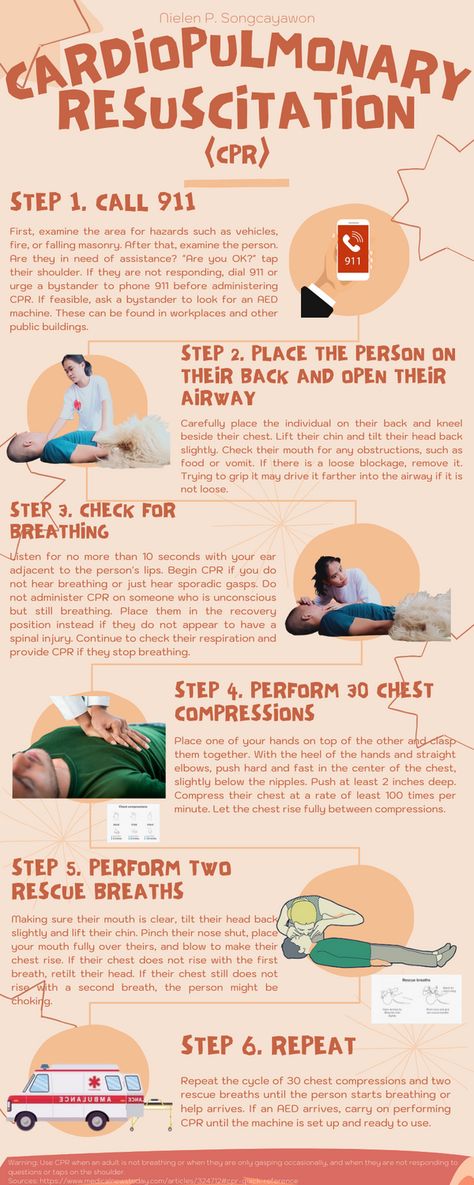 Step-by-step CPR process Cpr Notes, Cpr Steps, Cpr Poster, Cpr Instructor, Small Business Shirt, Health And Safety Poster, Cardiopulmonary Resuscitation, Safety Poster, Medical School Life