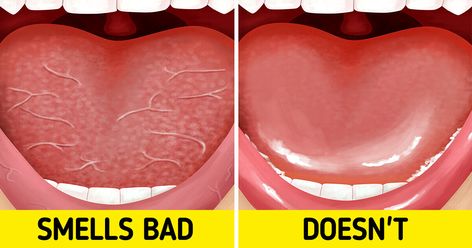 6 Effective Ways To Avoid Bad Breath Even After Sleeping Causes Of Bad Breath, Alcohol Free Mouthwash, Sugar Free Gum, Sugar Free Candy, Sugary Food, Carbohydrate Diet, Low Carbohydrate Diet, Low Carbohydrates, Healthy Smile