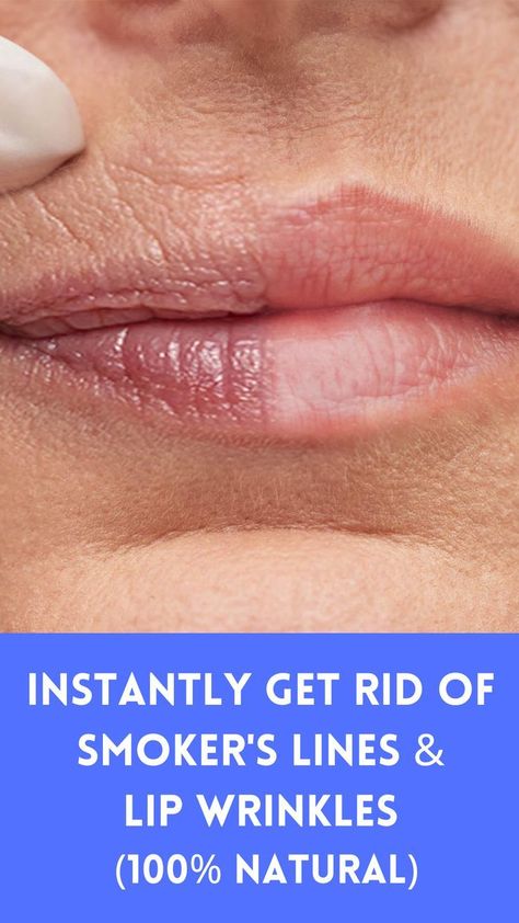 How To Maintain Healthy & Luminous Lips in 2022 | Lip wrinkles, Smokers lines, Lips Fuller Lips Makeup, Fuller Lips Naturally, Smokers Lines, Plump Lips Naturally, City Lips, Start Day, Lip Scrub Homemade, Fuller Lips, Chic Short Hair