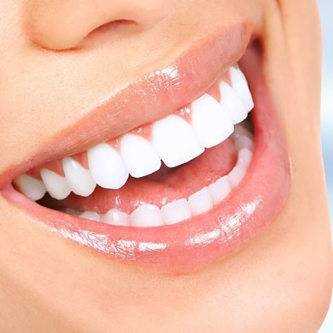 WHAT ARE THE INGREDIENTS OF CLEANER SMILE? Manifestation Results, How To Make Yellow, Natural Teeth Whitening Diy, Strong Teeth, Teeth Whitening Diy, Beautiful Teeth, Tooth Removal, Perfect Teeth, Yellow Teeth