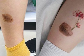 Birth Mark Cover Up Tattoo, Tattoo Birthmark Coverup, Tattoo Around Birthmark, Small Tattoo To Cover Scar, Birthmark Cover Up Tattoo, Small Scar Cover Up Tattoo, Birthmark Tattoo Ideas, Mole Cover Up Tattoo, Arm Lift Scar Tattoo Cover Up