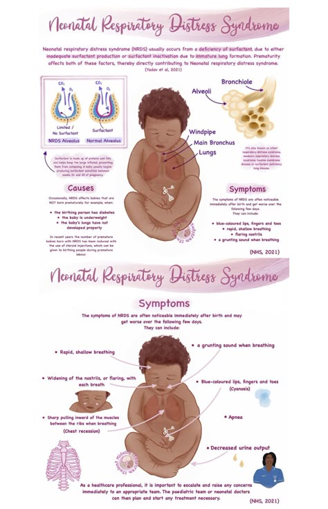 Neonatal Respiratory Distress Syndrome, Labor And Delivery Nursing School Notes, Pediatric Surgeon Notes, Nicu Nurse Tips, Nicu Nursing Notes, Neonatal Nurse Aesthetic Notes, Respiratory Distress Syndrome Newborn, Nicu Nurse Study Notes, Nicu Nurse Notes