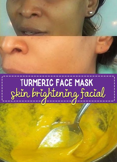 Turmeric Face Mask to Lighten Skin - brighten your skin in 15 minutes, great for removing scars and blemishes. Super easy to make and you can have bright, glowing skin in minutes. Turmeric Facial Mask, Turmeric For Skin, Face Mask For Acne, Skin Lightening Diy, Face Lightening, Acne Scar Mask, Turmeric Facial, Mask For Acne, Bright Glowing Skin