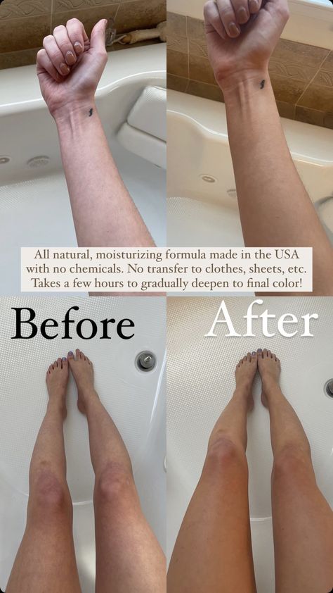 The EASIEST self tanner for fair skin - Botanic Tree Self Tanner from Amazon (code: ERICATAN25 for 25% off yours!) Natural Self Tanner Diy, Best Self Tanner For Fair Skin, Natural Self Tanner, Diy Self Tanner, Self Tanning Tips, Carrot Colour, Best Self Tanner, Amazon Codes, Tanning Tips