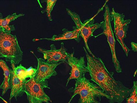 These are fluorescently labeled cells seen through a microscope! Fluorescent Microscopy, Microscopy Art, Confocal Microscopy, Microscopic Cells, Fluorescence Microscopy, Microscopic Photography, Microscopic Images, Electron Microscope, Microscopes