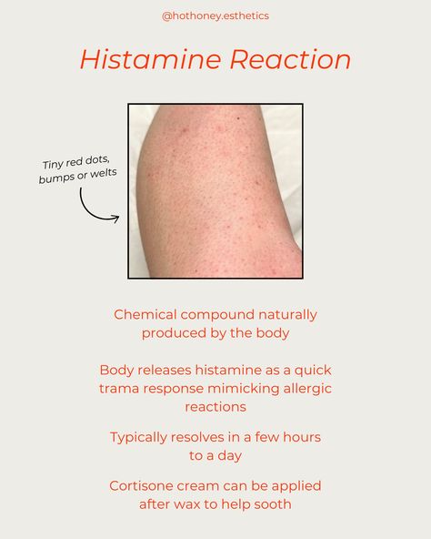 If your skin looks like this after a wax, it’s OK You guys…skin is weird! If you’ve experienced these skin reactions, it’s totally normal and totally something good pre and post wax home care can help to reduce. Some good tips to follow: - limit caffeine & alcohol the day of your appointment - Benadryl or an anti-histamine helps if you’re prone to histamine reactions - Shower on the day of your appointment - Follow all home care recommendations from your esti Hot Honey Esthetics 📍Ma... Thanksgiving Waxing Quotes, Post Waxing Care, Waxing Quotes, Spa Things, Waxing Tips, Esthetics Room, Hot Honey, Body Waxing, Allergic Reaction
