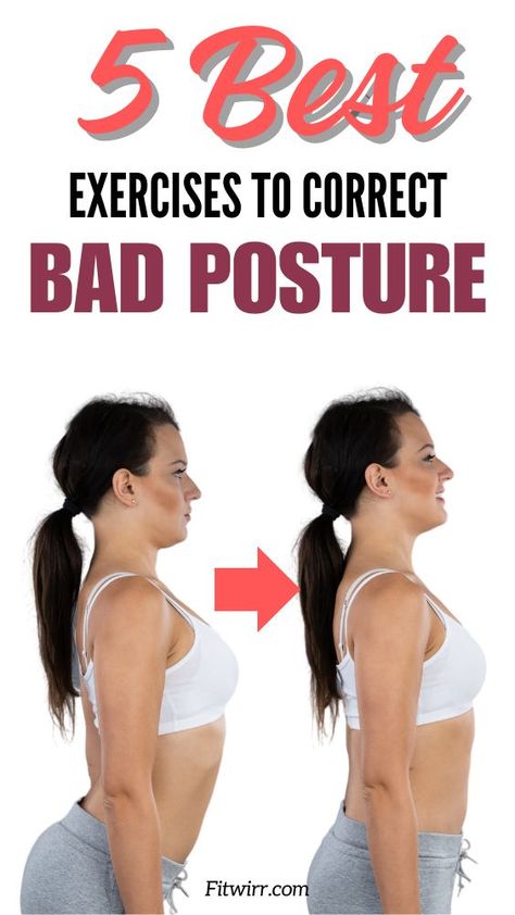 This pin features the pin title "5 daily exercises to correct bad posture", and images of a woman who has an improved better and straighter back posture and the before image where her back posture is poor. Body Posture Exercises, Fix Back Posture, Straight Back Posture, Bad Neck Posture, Bad Posture Exercises, Forward Head Posture Correction, Correct Bad Posture, Fix Posture, Fix Bad Posture