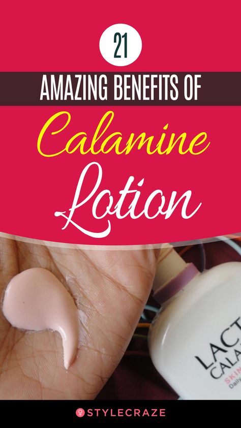 Back Acne Remedies, Calamine Lotion, Aloe Vera Face Mask, Beauty Tips And Tricks, Natural Sleep Remedies, Get Rid Of Blackheads, Cold Home Remedies, Beauty Advice, Mouthwash