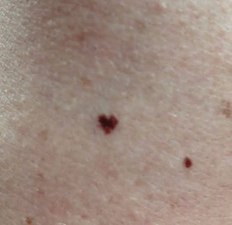 Cute Birthmarks Aesthetic, Birthmarks For Shifting, Body Moles Aesthetic, Heart Beauty Mark, Birthmarks Aesthetic, Heart Freckle Tattoo, Freckle Tattoo, Brown Tattoo Ink, Mole Tattoo