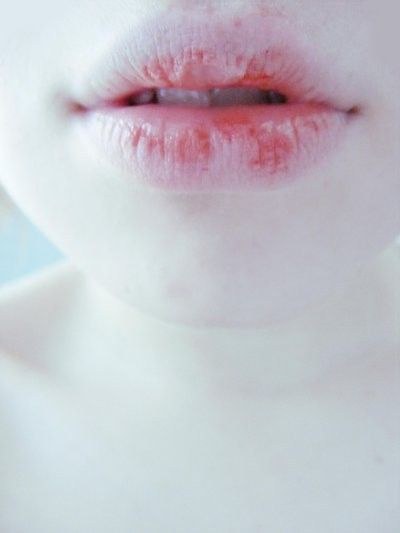 icy lips Pale Grunge, Chapped Lips, Pale Skin, 인물 사진, Pink Lips, Makeup Tips, Human Body, Lips, Angeles