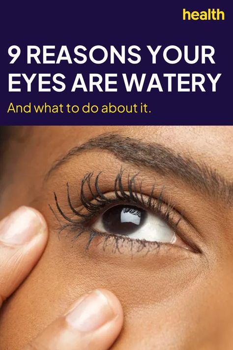 Best Eye Drops For Dry Eyes, Dry Eyes Remedy Natural Treatments, Watery Eyes Remedy, Eye Irritation Remedies, Tearing Eyes, Dry Eye Remedies, Eye Nerves, Blocked Tear Duct, Allergy Eyes