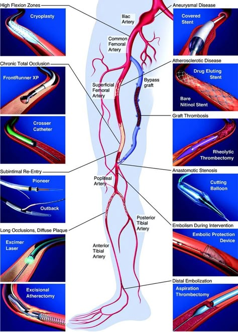 Cath Lab Nursing, Medical Sonography Student, Diagnostic Medical Sonography Student, Ultrasound School, Cardiac Sonography, Medical Terminology Study, Vascular Ultrasound, Sonography Student, Medical Sonography