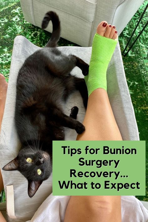 Achilles Surgery Recovery Tips, Bunionette Taping, Lapiplasty Surgery, Bunionette Surgery, Bunionectomy Recovery, Intention Board, Surgery Prep, Surgery Care Package, Preparing For Surgery