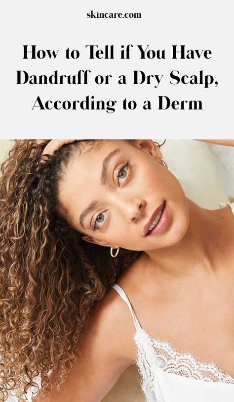 The Difference Between Dry Scalp and Dandruff How To Stop Dandruff Dry Scalp, White Flakes In Hair Dry Scalp, How To Stop Itchy Scalp, Dry Flaky Scalp Remedy, Flaky Scalp Remedy, Dry Scalp Vs Dandruff, How To Stop Dandruff, Haircare Ideas, Dry Scalp Remedy