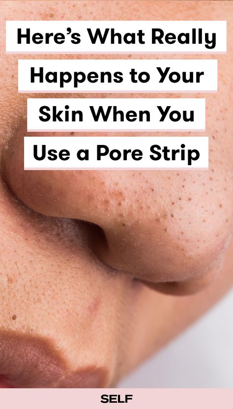 You either think pore strips are super gross or the best (and most satisfying) beauty invention ever. But, when you pull off a pore strip, the satisfying results you see might not be what you think. Here, derms explain everything you need to know about the gunk and what benefits these strips actually have. Diy Pore Strips, Pore Extraction, Homemade Pore Strips, Nose Pore Strips, Sebaceous Filaments, Nose Pores, Pore Strips, Oral Care Routine, Pore Cleansing