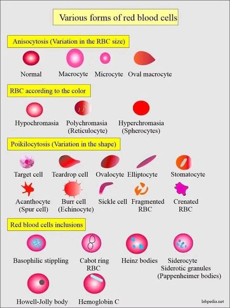 Medical Lab Technician, Medical Laboratory Technician, Abnormal Cells, Medical Laboratory Science, Biology Lessons, Medical School Inspiration, Biology Notes, White Blood Cells, Medical Laboratory