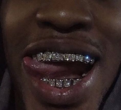 follow @trillexx #trillexx Braces, A Man, Close Up, Diamonds, Instagram