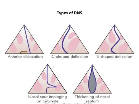 Nasal septum Nasal Septum, Head And Neck, Triangle Tattoo, Tattoos