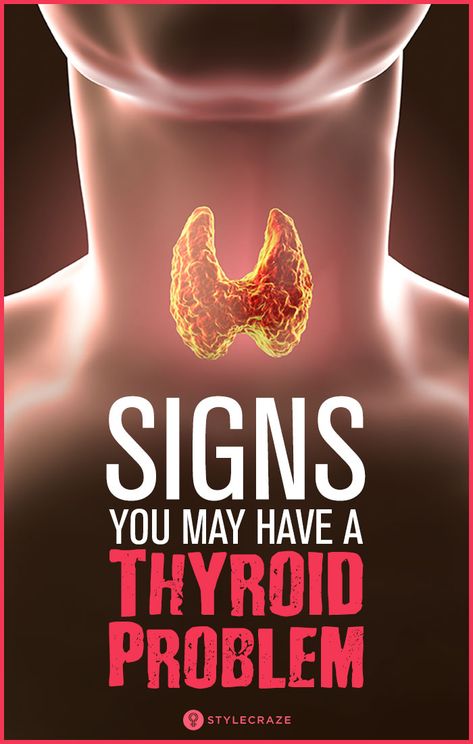 Thyroid Remedies, Workout Easy, Low Thyroid, Thyroid Symptoms, Thyroid Medication, Summer Smoothies, Thyroid Issues, Healing Waters, Thyroid Gland