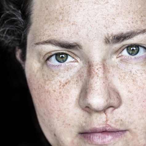 Woman With Freckles, Closeup Portrait, Cleft Lip, No Makeup, Female Portrait, Real People, Camera Photo