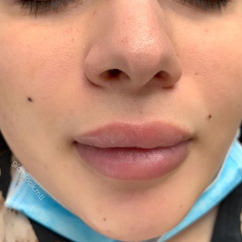 Cute Face Moles, Face Moles Beauty Marks Aesthetic, Beauty Spot Tattoo Face, A Mole On The Face, Cute Moles On Face Aesthetic, Women With Moles On Face, Facial Beauty Marks, Beauty Moles Aesthetic, Mole Above Lip Beauty Marks