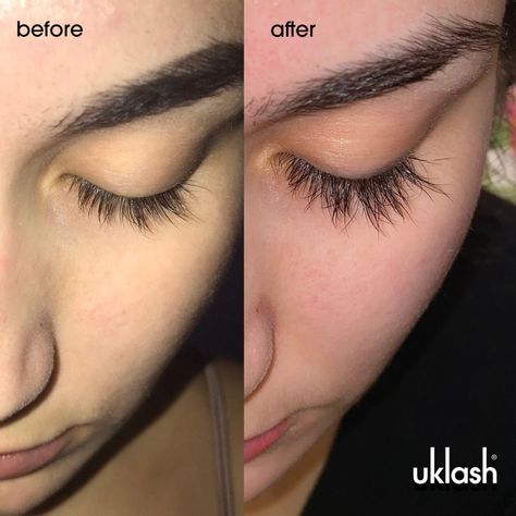 We’ve found the answer to lash goals and you’re welcome ✨ Our UKLASH Eyelash Serum is formulated full of vitamins, extracts + peptides to transform your eyelashes to their best 👏 📷: Customer results from 4 months of using the Eyelash Serum daily 🛍️Shop now: https://uklash.co/3Nk6cR3 #uklash #makeuproutine #lashgoals Long And Thick Eyelashes Natural, Eyelash Serum Results, Lash Serum Results, Long Lashes Natural, Natural Eyelash Growth, Big Nose Beauty, Big Lashes, Eyelash Lift, Thicker Eyelashes