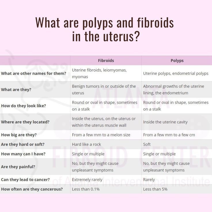 polyps vs fibroids Polyps Uterus, Uterine Polyps, Delivering A Baby, The Patient, Health Education, Cavities, Fertility, Health Care, Medical