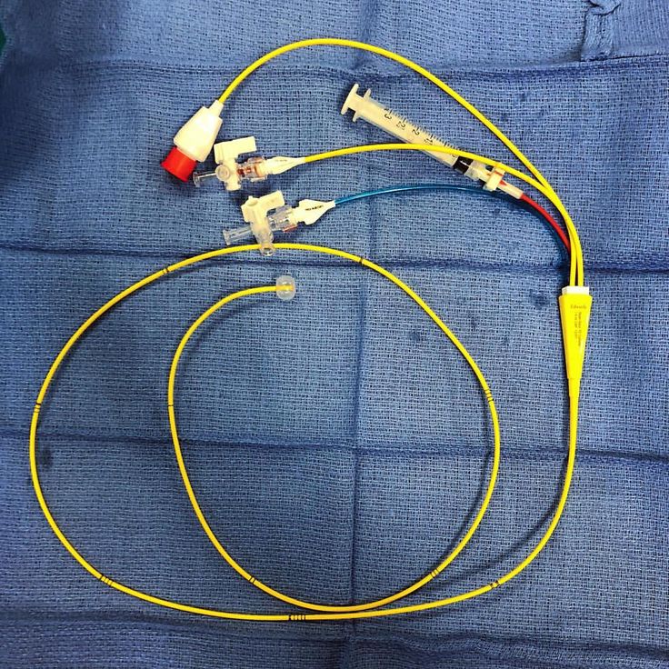 The Swan Ganz catheter. Also known as a right heart cath, this is an important tool in cardiology for the assessment of intracardiac… Swan Ganz Catheter, Cardiology, Assessment, Nursing, Hoop Earrings, On Instagram, Instagram