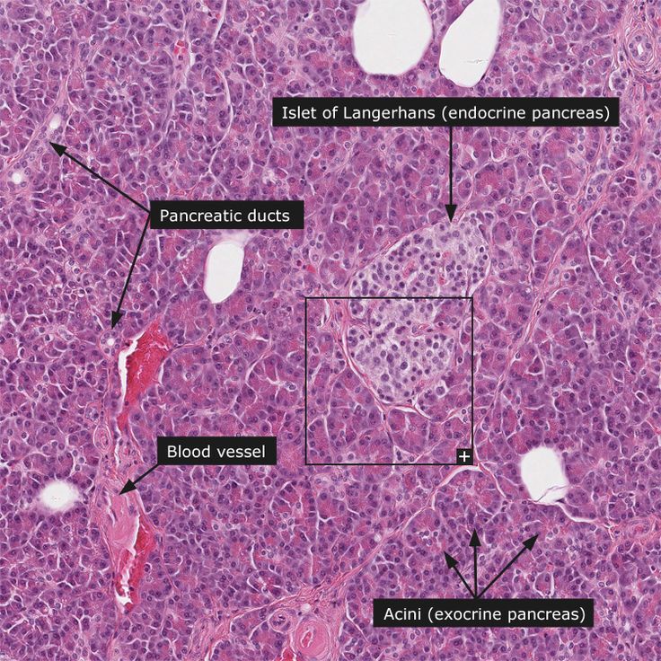 an image of the endocinoma and its structures