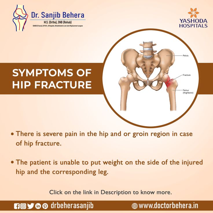 Symptoms of Hip Fractures... For more details visit: http://doctorbehera.in/hip-fracture-and-treatment-hyderaba…/  #orthopedicmedicin #orthopedicsurgeon #orthopedicdoctor #health #inspirational #tipoftheday #doctor #surgeon #inspire #medicine #orthopedics #orthopedic #healthy #orthotips Hip Fracture, Healthy Tips, The Field, Hyderabad, 20 Years, Medicine, Medical, Health