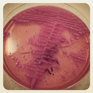 a pink substance in a petri dish with water droplets on the bottom and sides