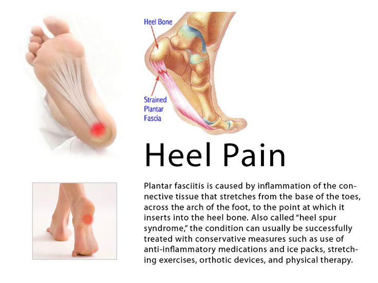 Relieve heel pain with The Miracle Wave TODAY! TheMiracleWave.com Calf Cramps, Running Injuries, Heel Pain, Puffy Eyes, Organic Health, Foot Pain, Natural Treatments, Workout Programs, Back Pain