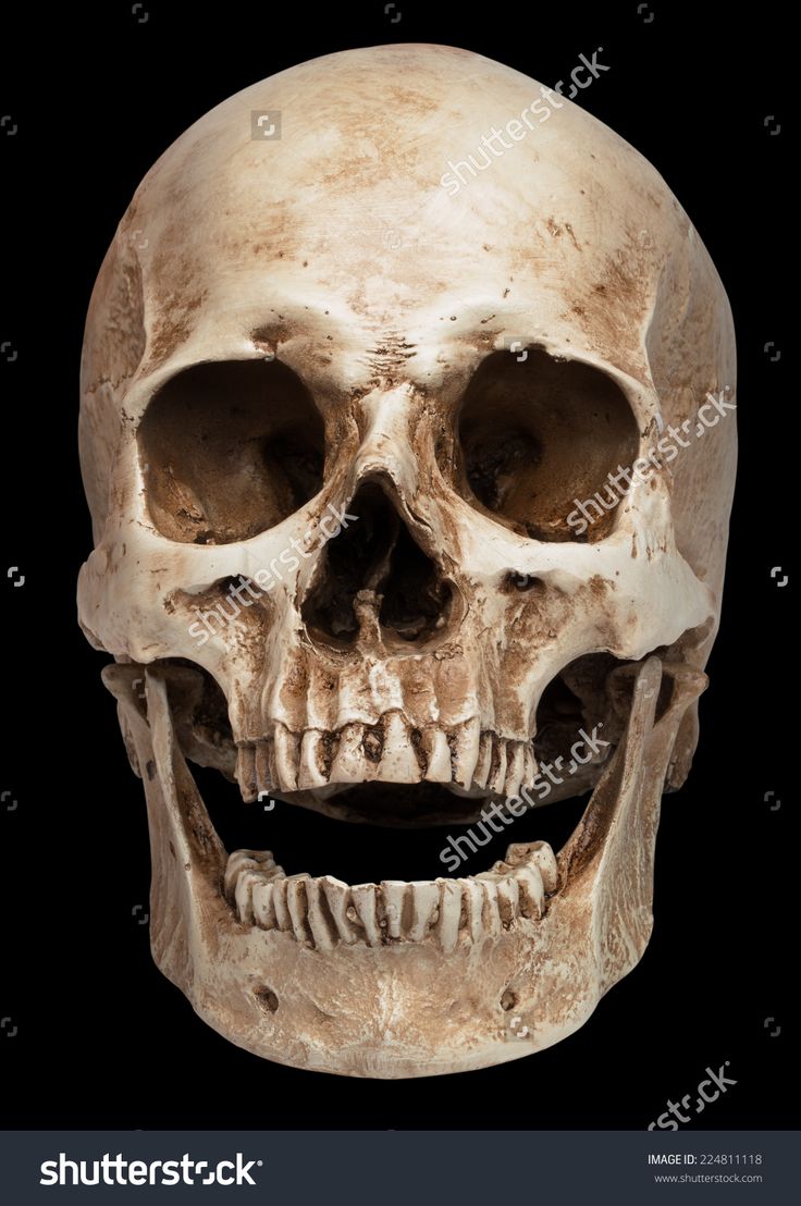 a human skull on a black background with clippings for the lower jaw and upper jaw