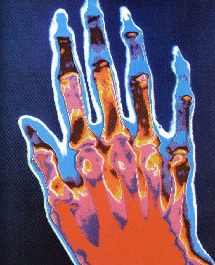 an image of a hand that has been altered to look like it is in color