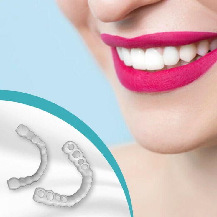 Magic teeth brace snap on smile Orthodontic Braces Perfect Smile Teeth, Snap On Smile, Picture Perfect Smile, Braces Cost, Teeth Covers, Braces Off, Perfect Teeth, Teeth Braces, Smile Teeth