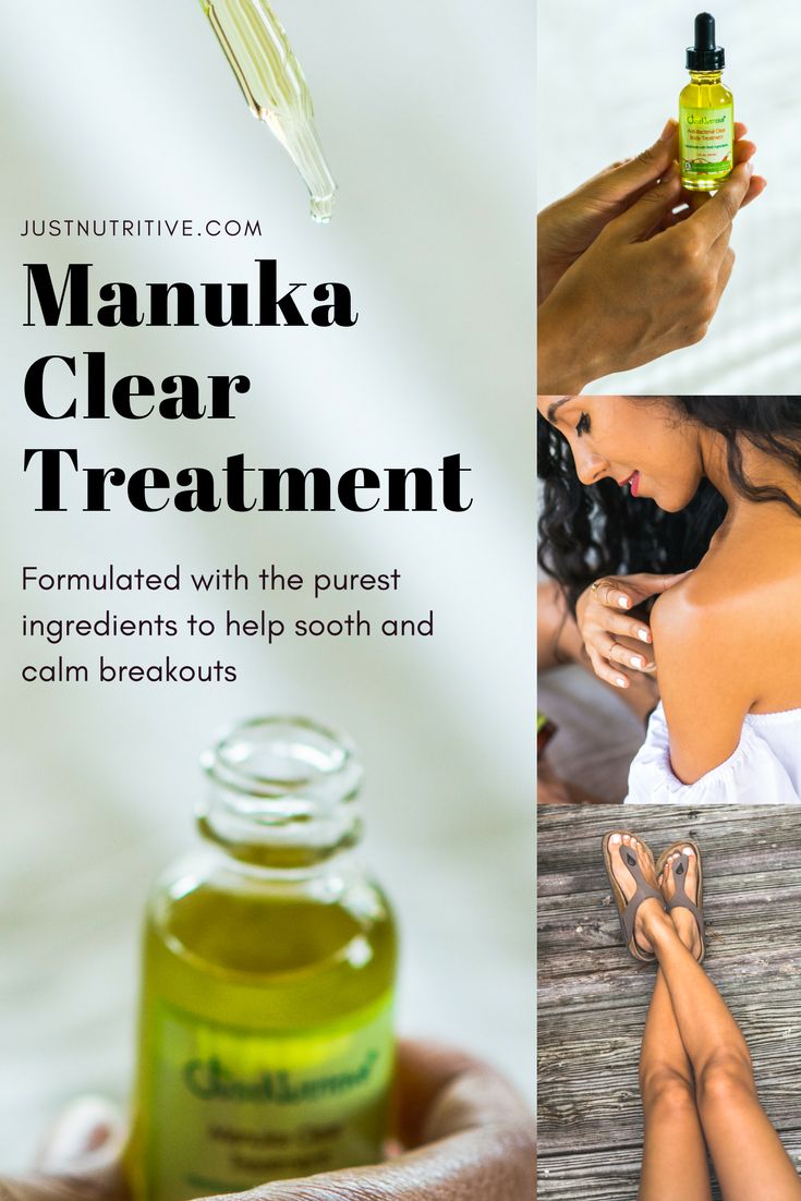 Manuka Oil is extracted from the Manuka tree found in New Zealand. It’s known to be used as a key ingredient in many beauty products. Manuka Tree, Manuka Oil, Anti Itch Cream, Essential Oils Herbs, Beauty Remedies, Acne Remedies, Skin Remedies, Diy Recipes, Beauty Recipe