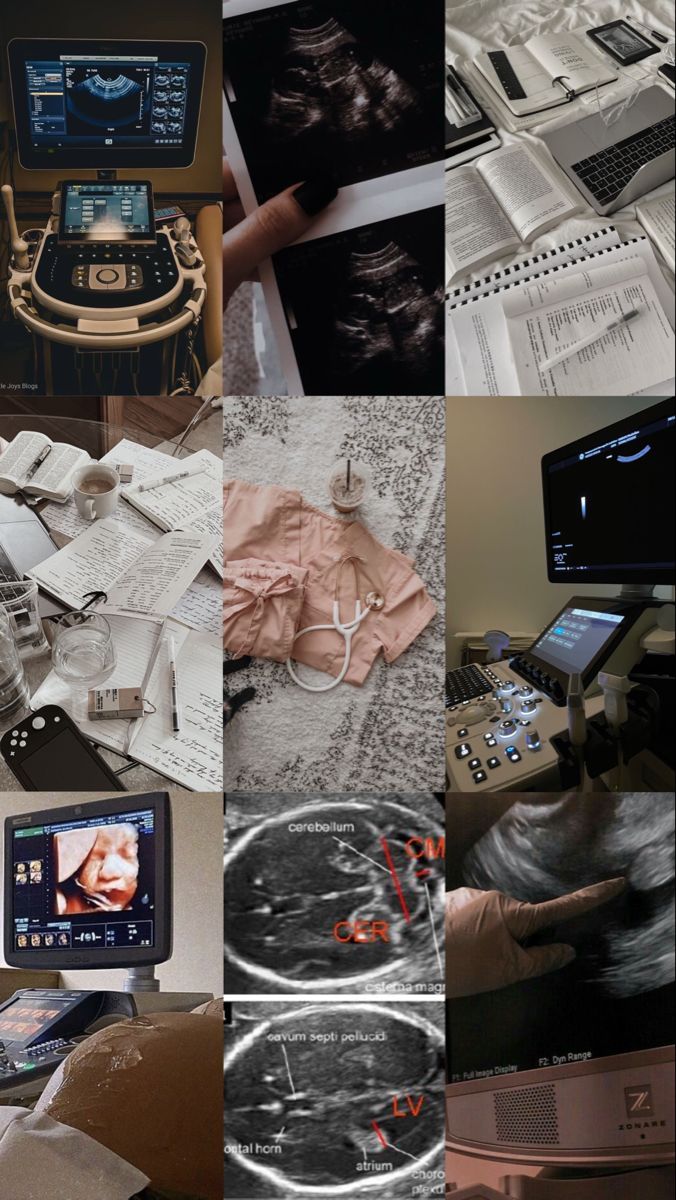 Ultrasound tech/ sonographer
/ Sonography Nurse Tech Aesthetic, Medical Imaging Aesthetic, Future Cardiologist Aesthetic, Ultra Sound Tech Schooling, Ct Tech Aesthetic, Cardiac Ultrasound Tech, Ultrasound Vision Board, Medical Technician Aesthetic, Obstetric Sonographer Aesthetic