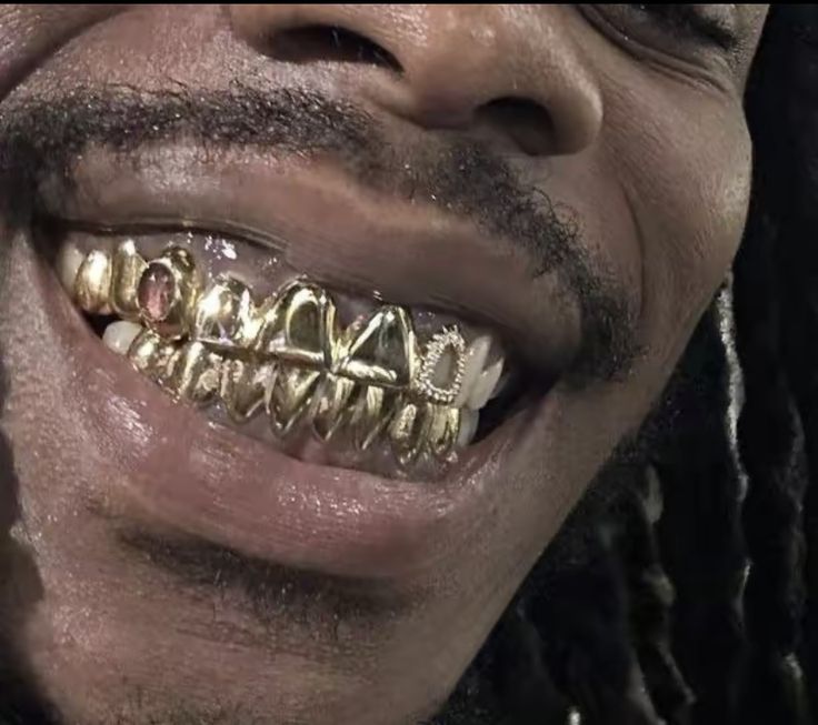 Gold Teeth Grills, Look Hip Hop, Grillz Teeth, Gold Grill, Diamond Teeth, Tooth Gems, Gold Grillz, I Love Being Black, Grills Teeth