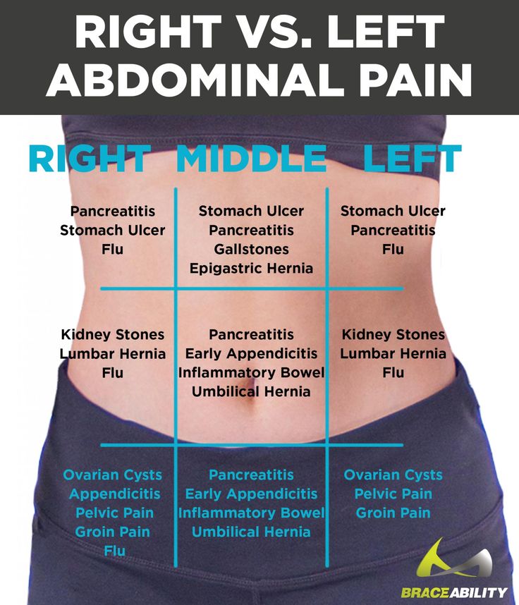 There are a number of reasons women would feel pain in their abdomen, use this graphic to help get some insight if it's something minor or something more serious like pancreatitis, kidney stones or ovarian cysts. Fingers crossed its only the flu! Abdominal Pain Relief, Back Pain Remedies, Stomach Ulcers, Pelvic Pain, Back Pain Exercises, Stomach Pain, Abdominal Pain, Back Pain Relief, Back Pain