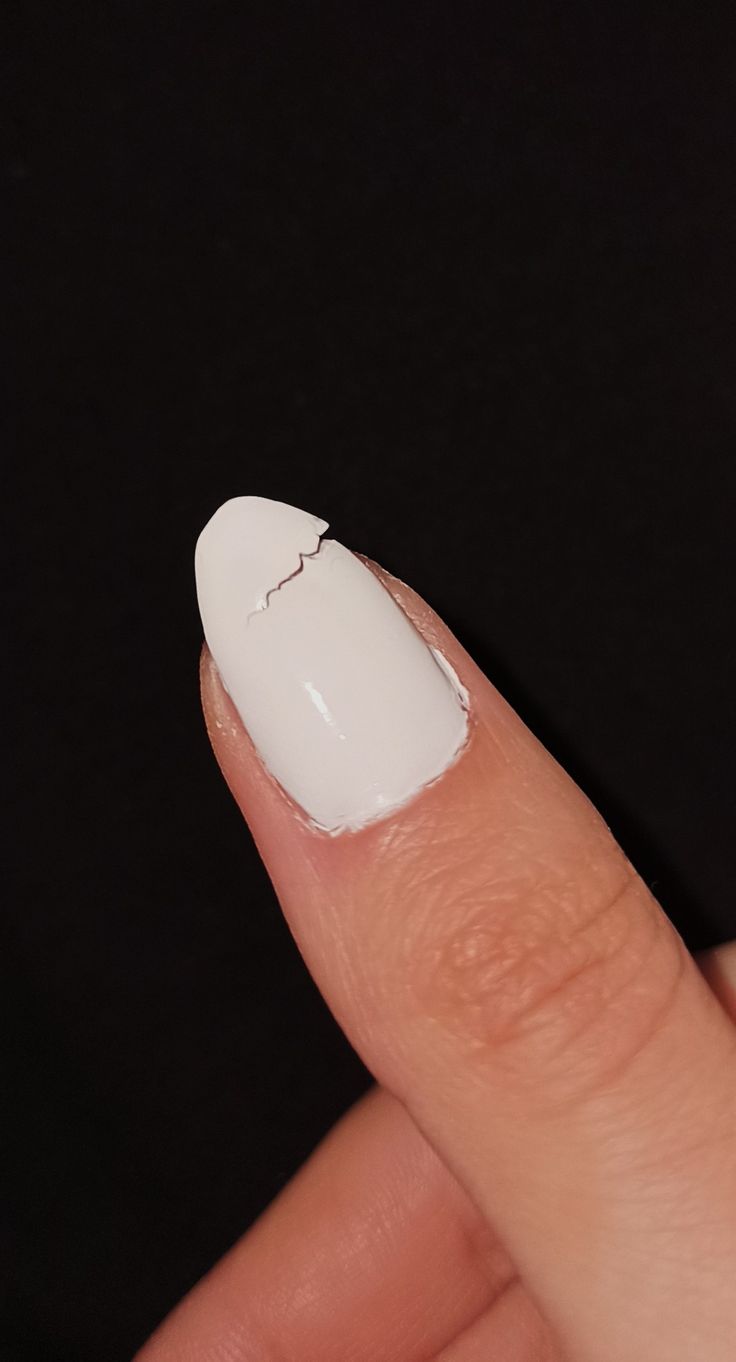 nail
broken nail
nails
nail art
nailart
sad Nails Snap, The Selection Book, Neymar Hot, Cute Relationship Pictures, Broken Nails, Ginger Hair Color, Nail Pictures, Casual Indian Fashion, Broken White