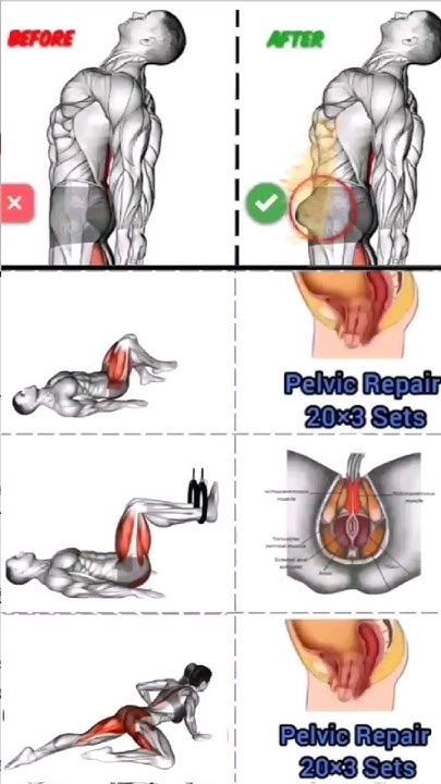 an image of how to do exercises for back pain