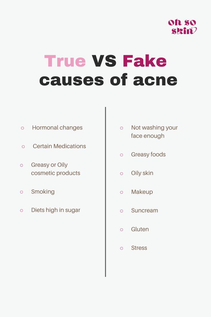 There are many myths around acne, what causes it and how to treat it especially. Here are some of the actual causes of acne, along with some myths to not believe. #skincare #acne #causesofacne #treatacne Treat Hormonal Acne, Acne Prone Skin Care Routine, Get Rid Of Acne Overnight, Causes Of Acne, Face Mapping Acne, Zits Popping, Acne Prone Skin Care, Skincare Acne, Bad Acne