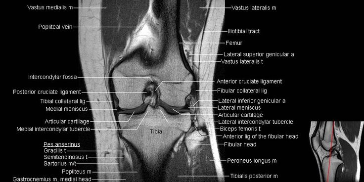 Meniscus Ligament Knee Anatomy