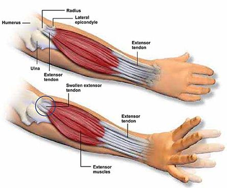 the muscles are labeled in red and white