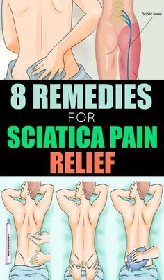 Headache Relief Instant, Natural Headache, Sciatica Exercises, Sciatica Pain Relief, Sciatica Relief, Natural Headache Remedies, Nerve Pain Relief, Sciatic Nerve Pain, Sciatica Pain