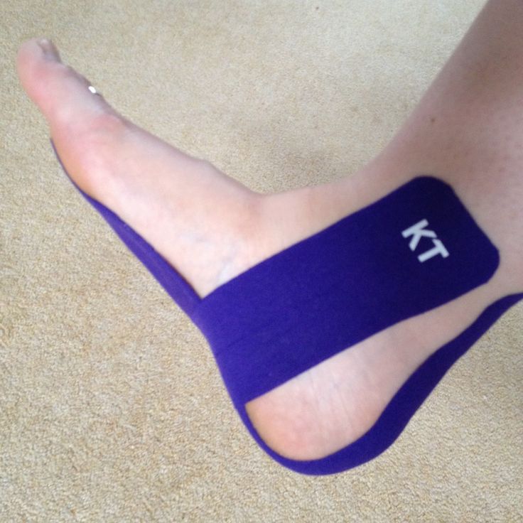 KT Tape purple awesomeness for my Plantar Fasciitis. #kttape Plantar Fascitis, K Tape, Heel Spur, Kinesio Tape, Kt Tape, Kinesio Taping, Chiropractic Adjustment, Kinesiology Taping, Heel Pain