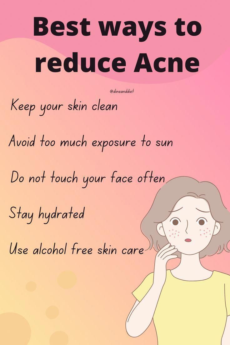 How To Avoid Pimples, Skincare For Oily Skin, How To Reduce Pimples, Acne Skincare, Survival Skills Life Hacks, Reduce Acne, Pimple Marks, Hormonal Changes, Sun Rays