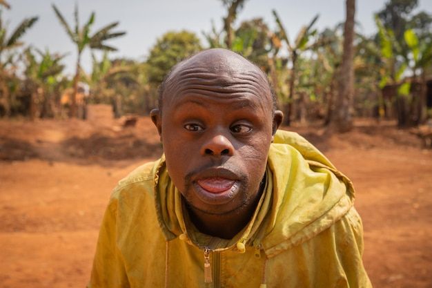 a man in a yellow jacket is looking at the camera and has his mouth open