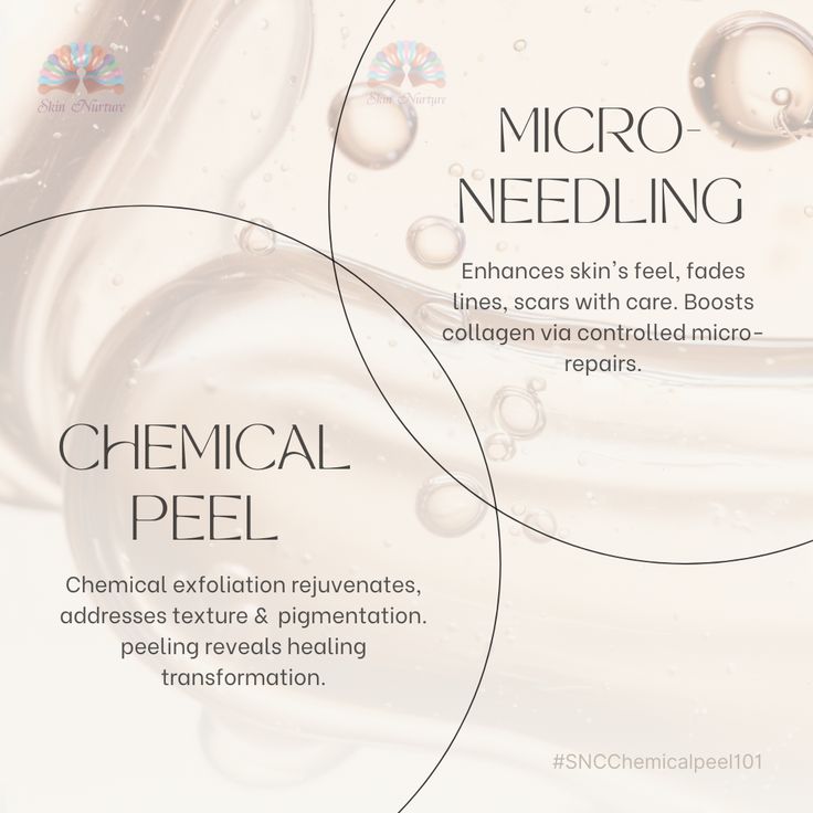 𝗧𝗵𝗲 𝗥𝗮𝗱𝗶𝗮𝗻𝗰𝗲 𝗥𝗲𝘃𝗶𝘃𝗲𝗿: Chemical peels utilize specialized solutions to exfoliate the skin's surface, revealing a fresh, glowing complexion underneath. They're like a rejuvenating potion for your skin, addressing concerns like dullness, fine lines, and hyperpigmentation with ease! 🌟  Microneedling,  𝗧𝗵𝗲 𝗖𝗼𝗹𝗹𝗮𝗴𝗲𝗻 𝗕𝗼𝗼𝘀𝘁𝗲𝗿, involves using tiny needles to create controlled micro-injuries in the skin, stimulating collagen and elastin production. What Is Microneedling, Med Spa Instagram Post Ideas, Med Spa Instagram Feed, Med Spa Marketing Ideas, Chemical Peel Aesthetic, Microneedling Aesthetic, Peel Season, Medspa Aesthetic, Medspa Marketing